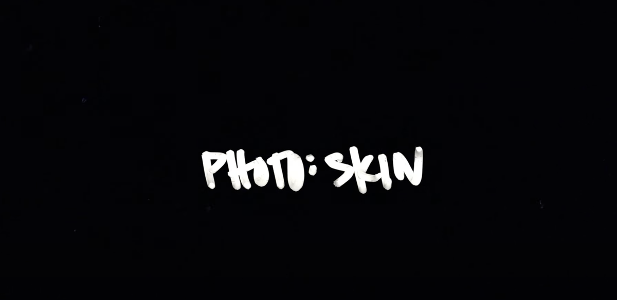 Photo: Skin